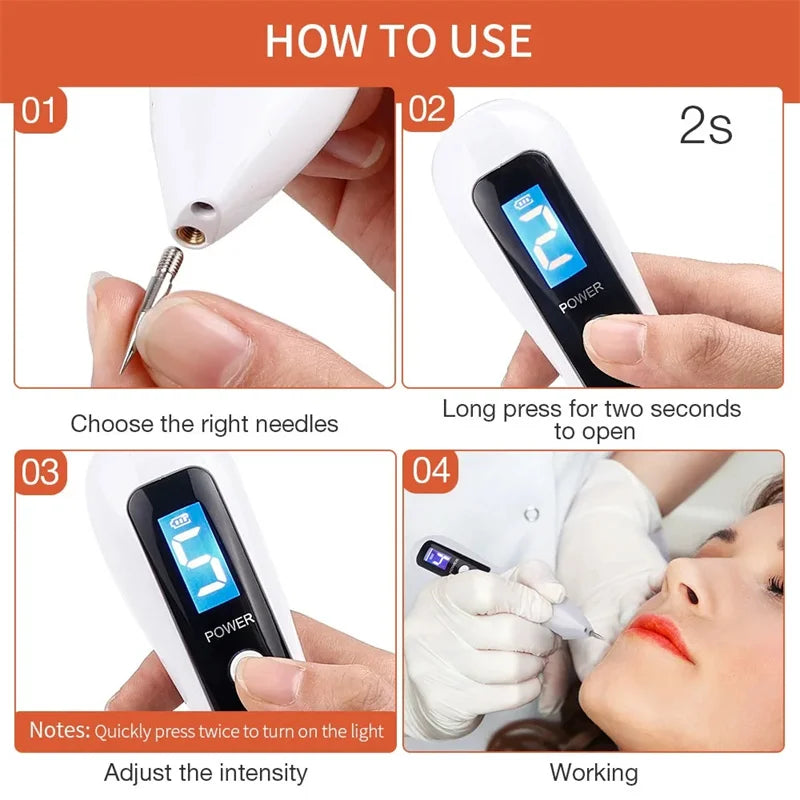 UBilli Beauty Laser Plasma Pen Freckle Remove Pen Wart Remover Tattoo Remover Instruments Skin Tag Removal Spot Beauty Care Tool