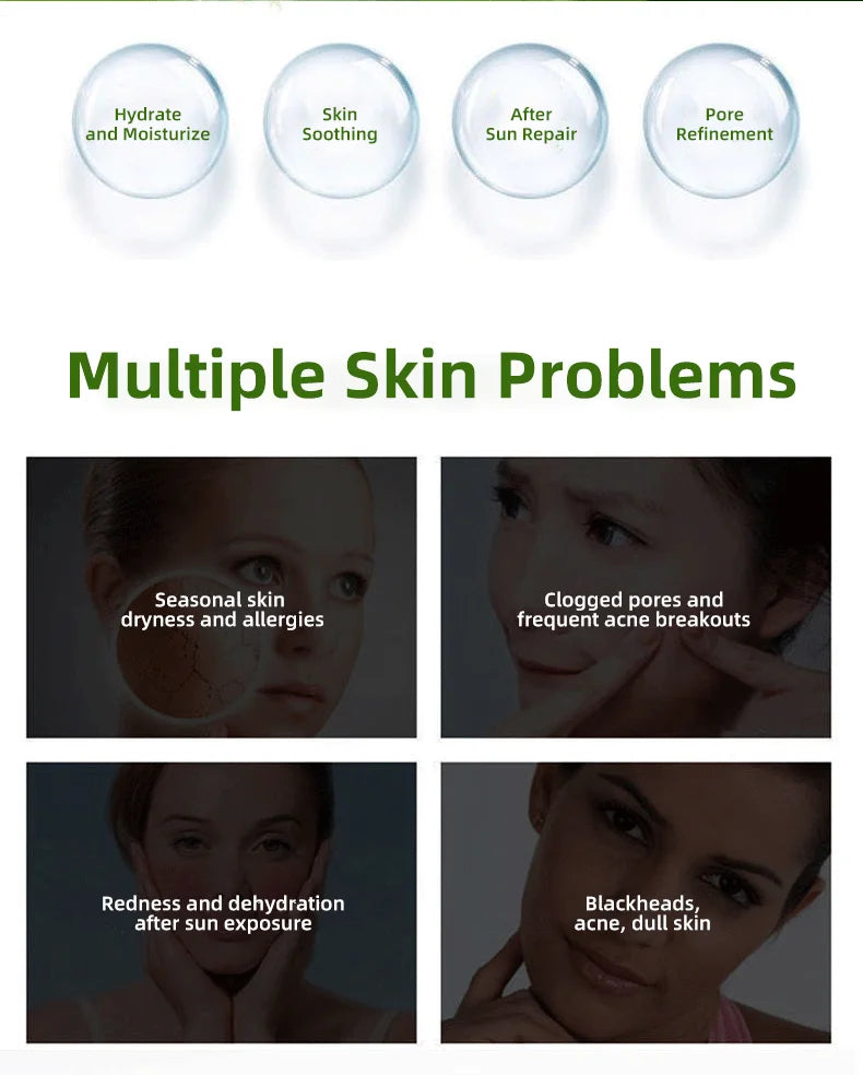 Youbuy Aloe Gel Gel Moisturizing Facial Brightening Skin Care Product