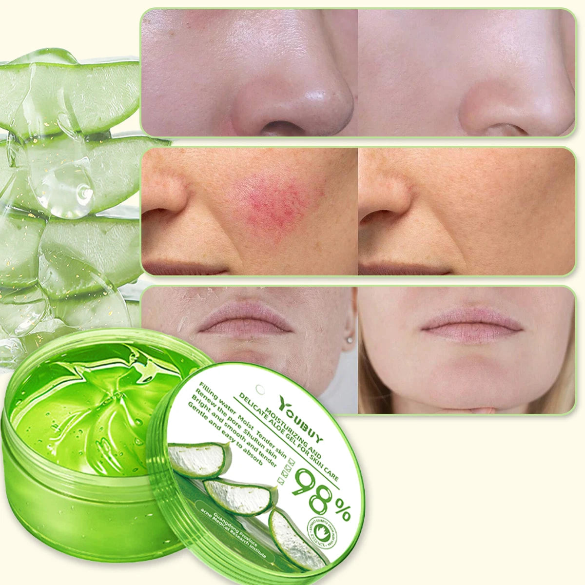 Youbuy Aloe Gel Gel Moisturizing Facial Brightening Skin Care Product